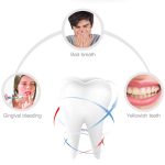 TW1 Teeth Whitening Automatic Toothbrush – Ultrasonic 360° U-Shaped Electric Brush with LED Whitening, IPX7 Waterproof, Rechargeable - Image 5